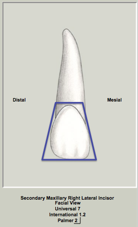 Mx Lateral Facial Trapezoid.png